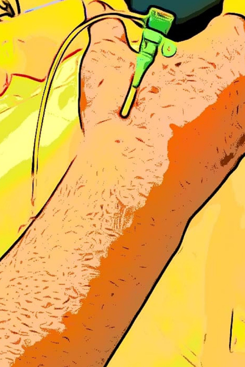 El Bileğinden Anjiyo